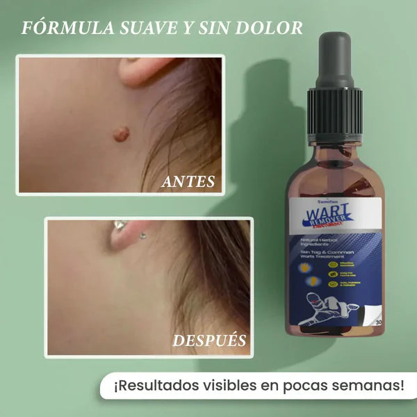 ACEITE ELIMINA VERRUGAS