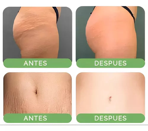 PASTEL CREAM ANTIESTRIAS REPARACION