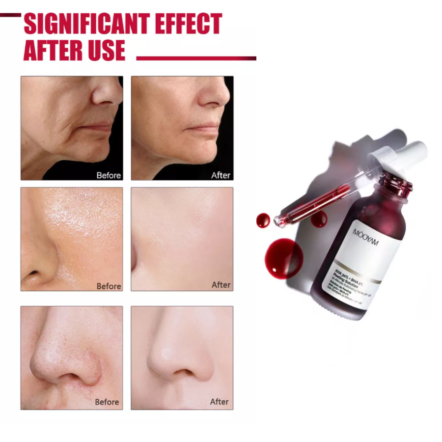 SUERO EXFOLIANTE PEELING FACIAL
