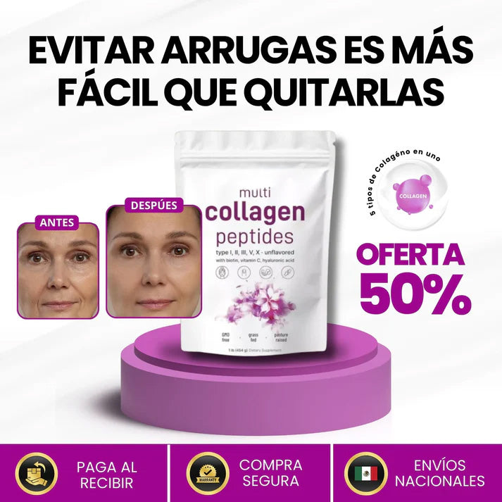 COLAGENO MULTIPLE 5 EN 1 – FORTALECE ARTICULACIONES, PIEL Y CABELLO
