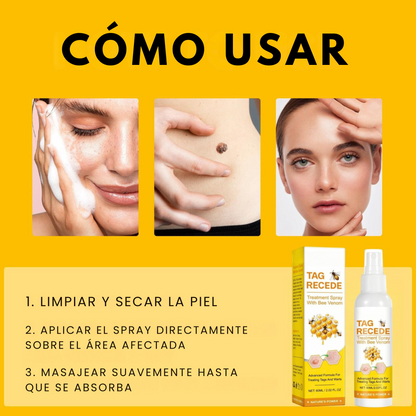 Spray Bee Venom – Elimina verrugas de forma segura, sin dolor ni cicatrices