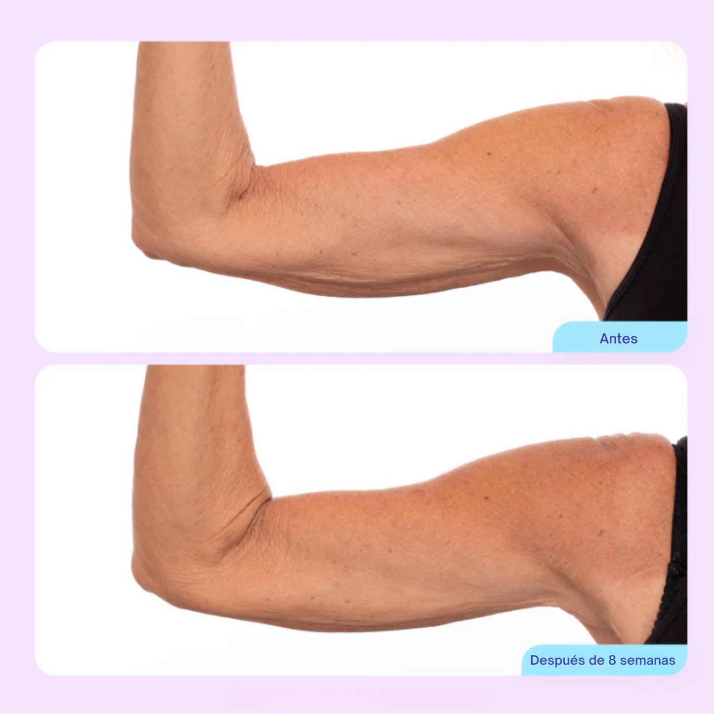 Crema Esculpidora y Tonificante para Brazos