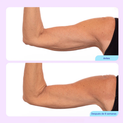 Crema Esculpidora y Tonificante para Brazos