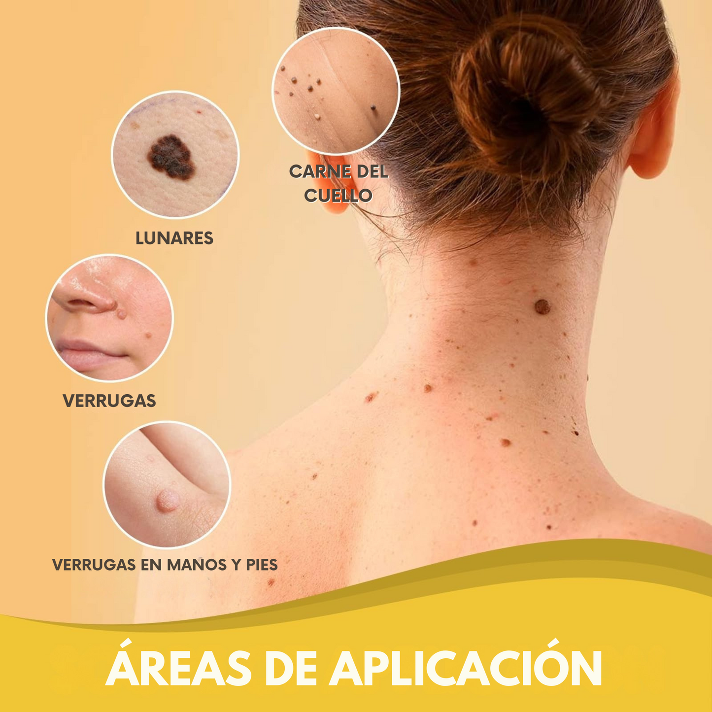 Spray Bee Venom – Elimina verrugas de forma segura, sin dolor ni cicatrices