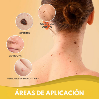 Spray Bee Venom – Elimina verrugas de forma segura, sin dolor ni cicatrices