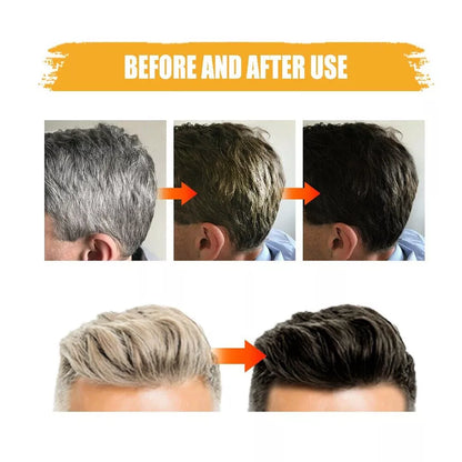 🚨SOLO HOY PAGA 1 LLEVA 2 BLACK SOAP SHAMPOO ANTI-CANAS💇‍♂️💇‍♀️