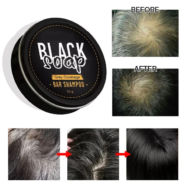 🚨SOLO HOY PAGA 1 LLEVA 2 BLACK SOAP SHAMPOO ANTI-CANAS💇‍♂️💇‍♀️