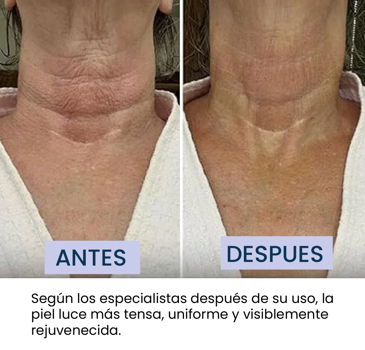 CREMA REPARADORA CUELLO