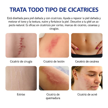 CREMA ELIMINA CICATRICES