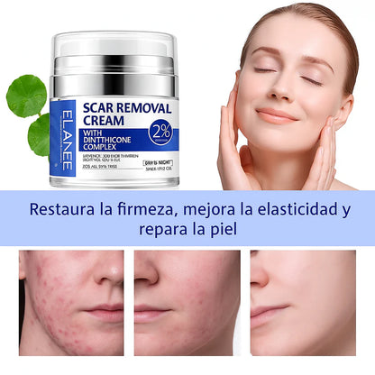 CREMA ELIMINA CICATRICES