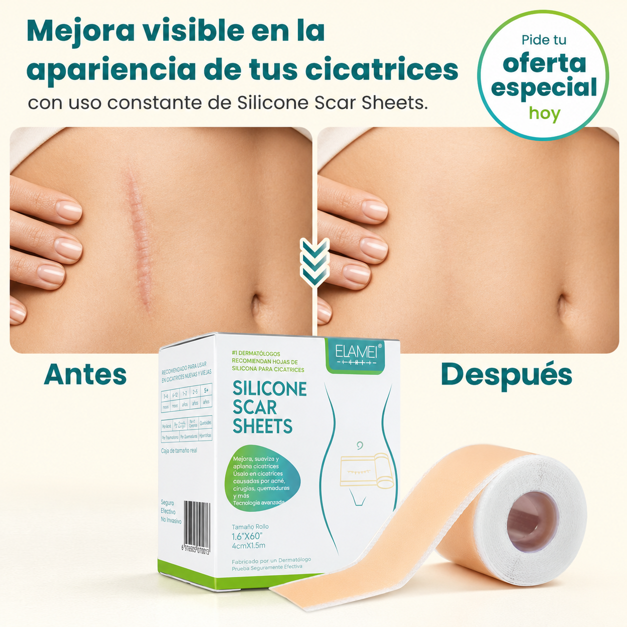 2X1 Silicone Scar Sheets – Láminas de Silicona para Cicatrices.