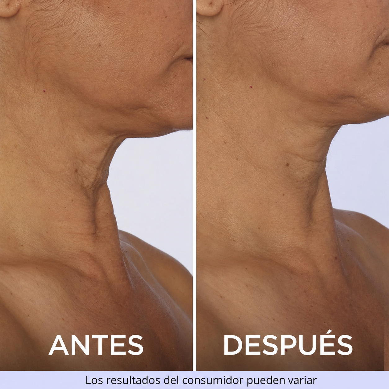 CREMA DE CUELLO