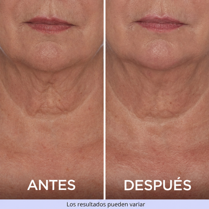CREMA DE CUELLO