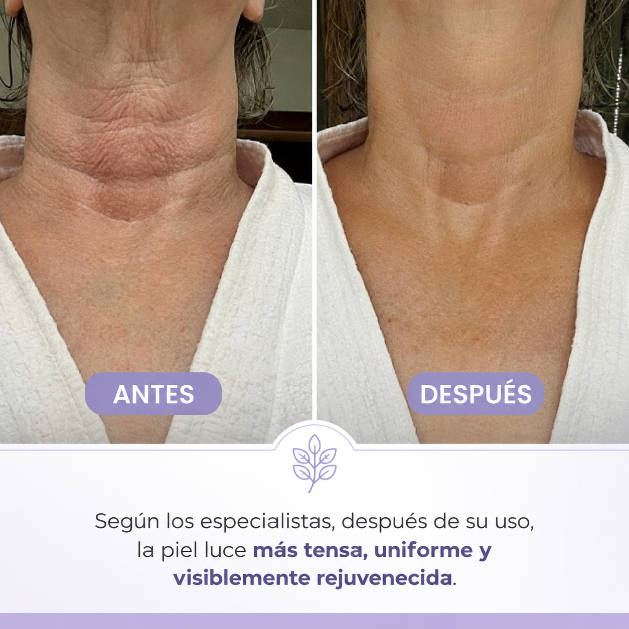 CREMA DE CUELLO