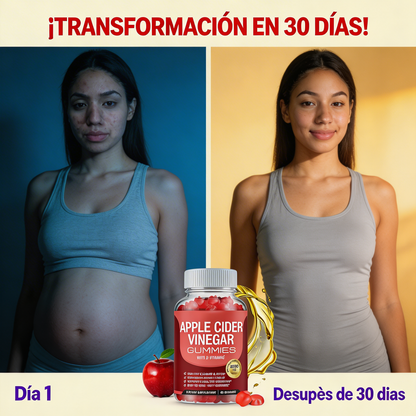 Gomitas de vinagre de manzana-Apoya a la digestión y controlar el apetito.