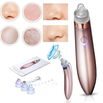EXTRACTOR DE ESPINILLAS
